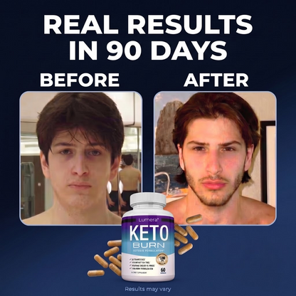 Lumera® Keto Burn
