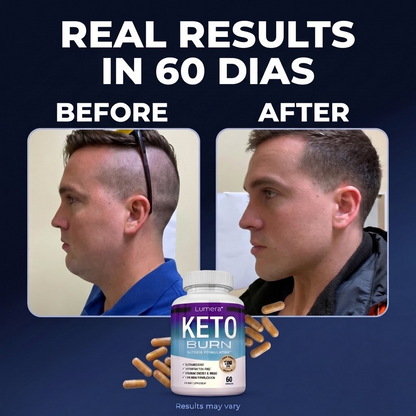 Lumera® Keto Burn