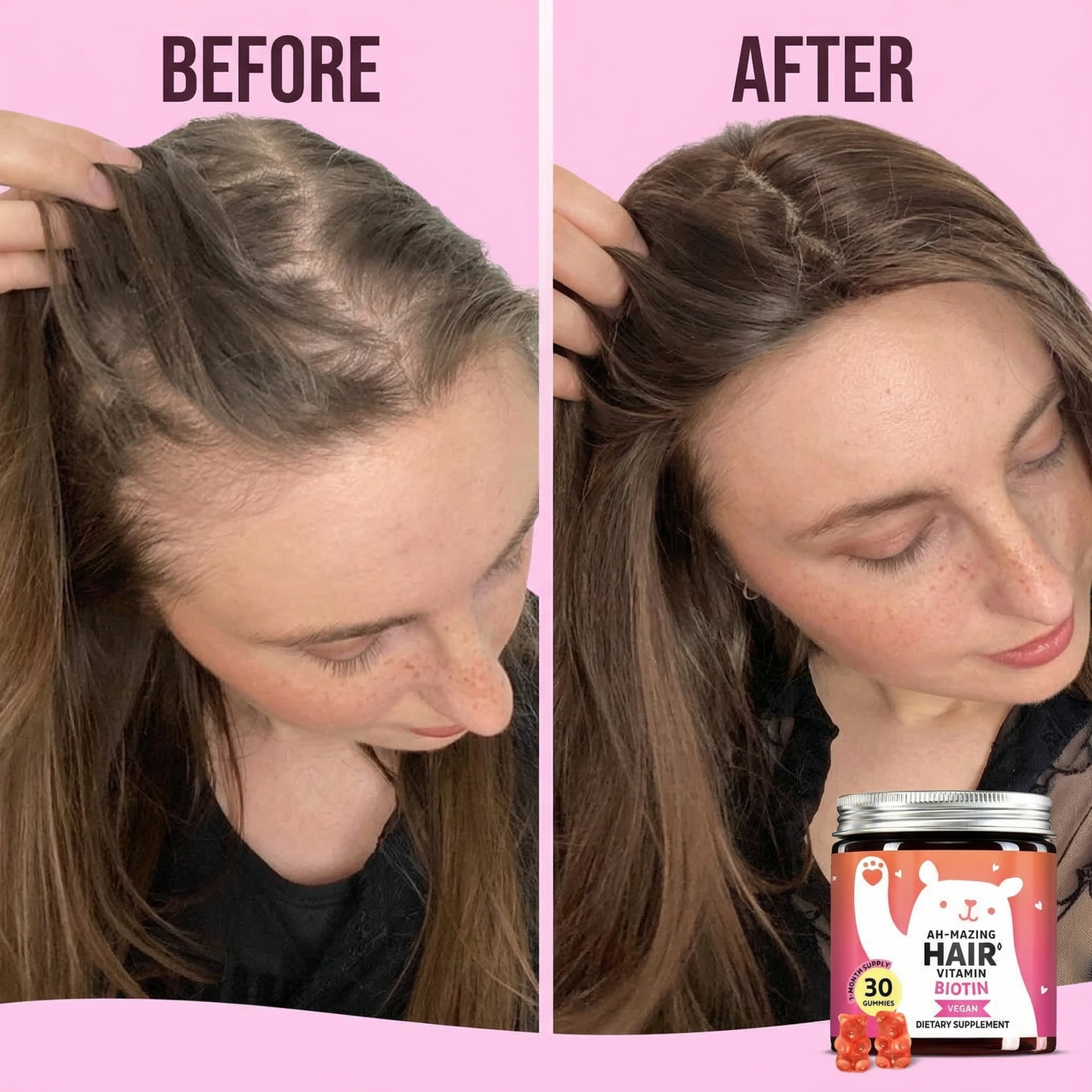 Lumera® Biotin Hair Growth Gummies